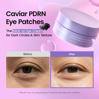 Caviar PDRN Eye Patches - Glow Skin Products